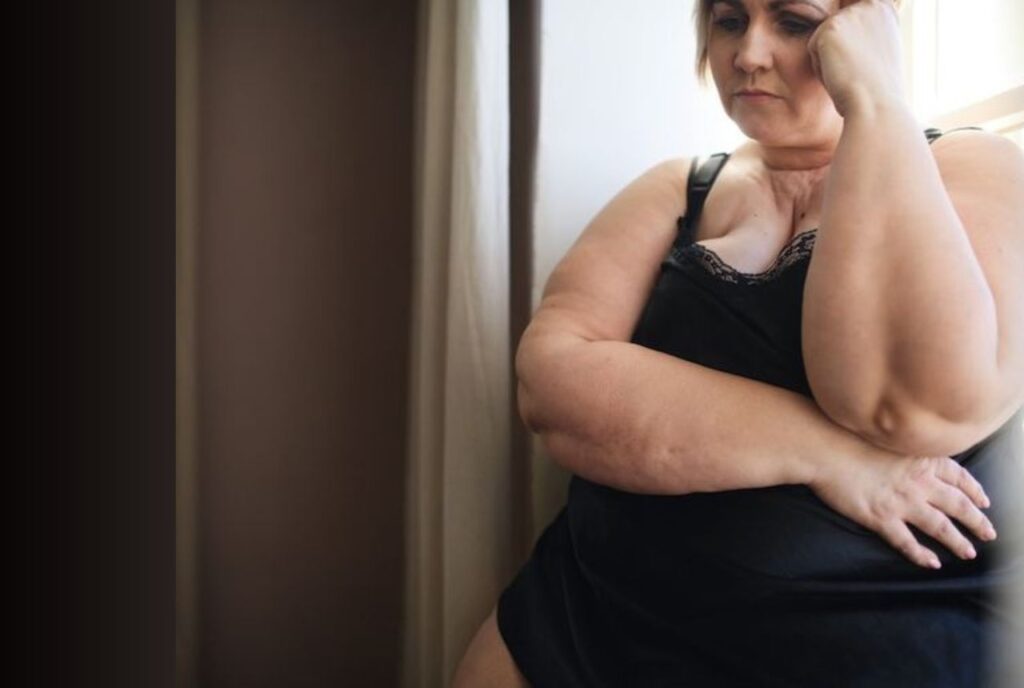 Increased Risk of Obesity and Weight Management Issues