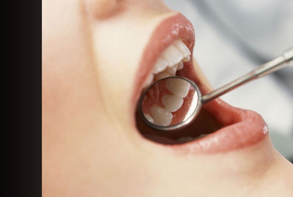 Dental Problems and Oral Health Issues
